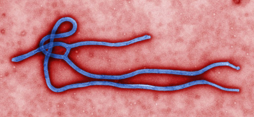Ebola virus virion, created by GC microbiologist Cynthia Goldsmith