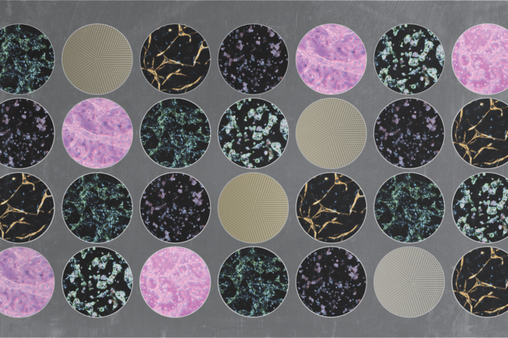 Feature image for "Revealing the Ancestry 'Blind Spot'", from the Summer 2022 issue of Explore