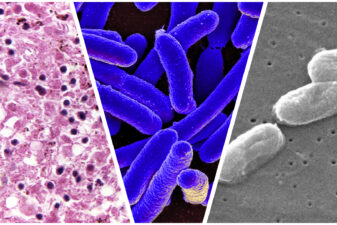 Compilation of microscopic imaging of antibiotic resistant bacteria